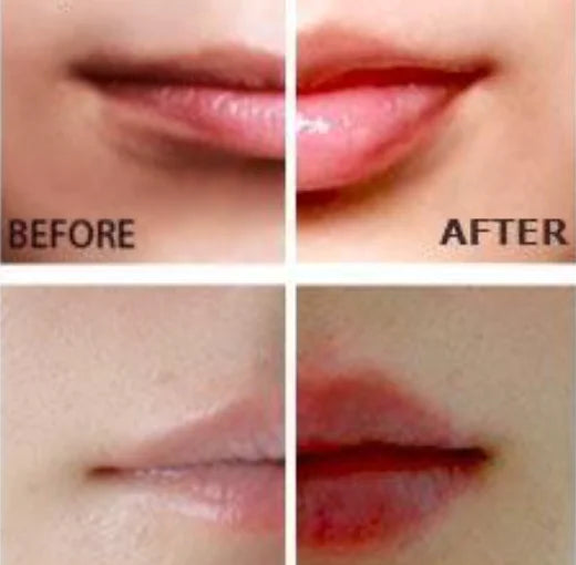 Miracle Lip Plumper – Preenchimento e hidratação instantâneos com vasodilatação natural